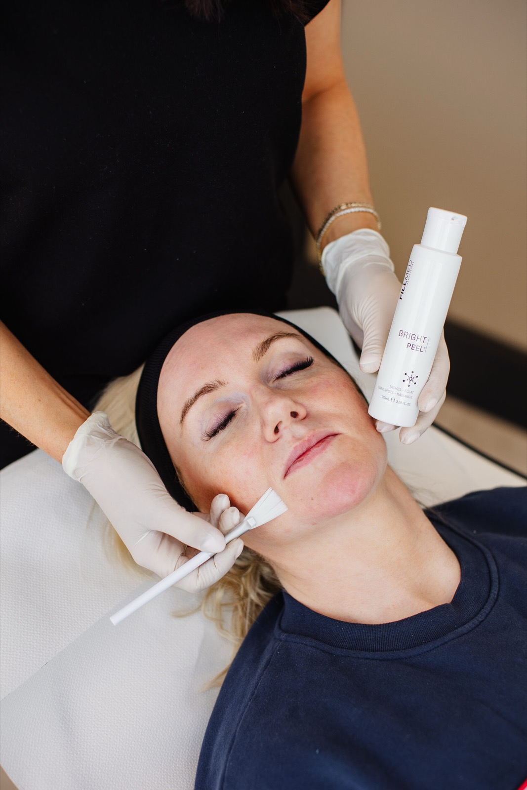 Medical-Grade Skin Peels at Dr. Gráinne Ryan Medical Aesthetics